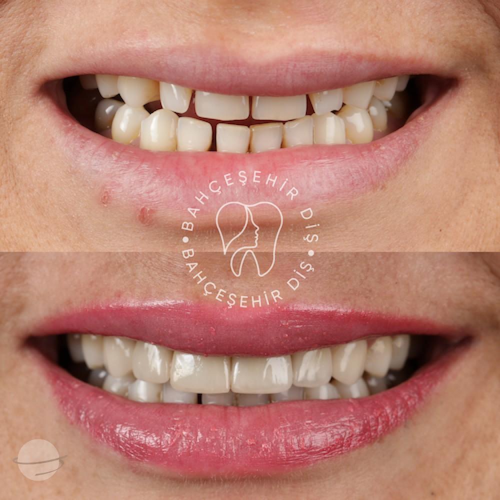 DA VINCI DENTAL RESULTS17