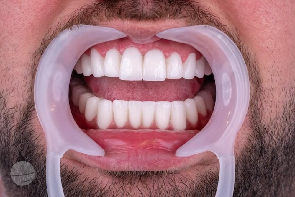 ZenSmileTown Dental Results29