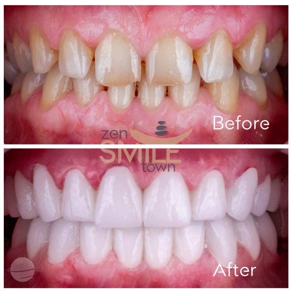 ZenSmileTown Dental Results21