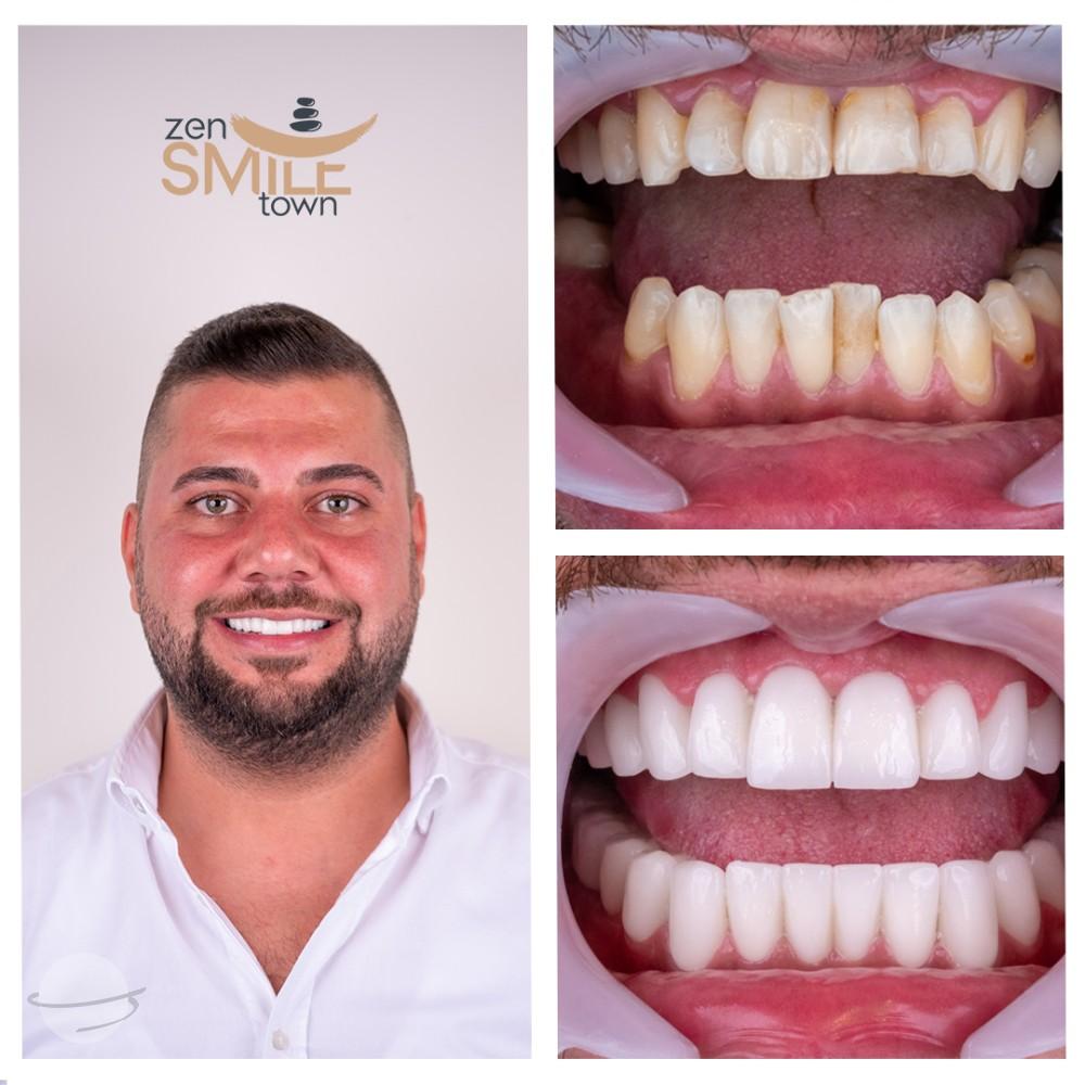 ZenSmileTown Dental Results24