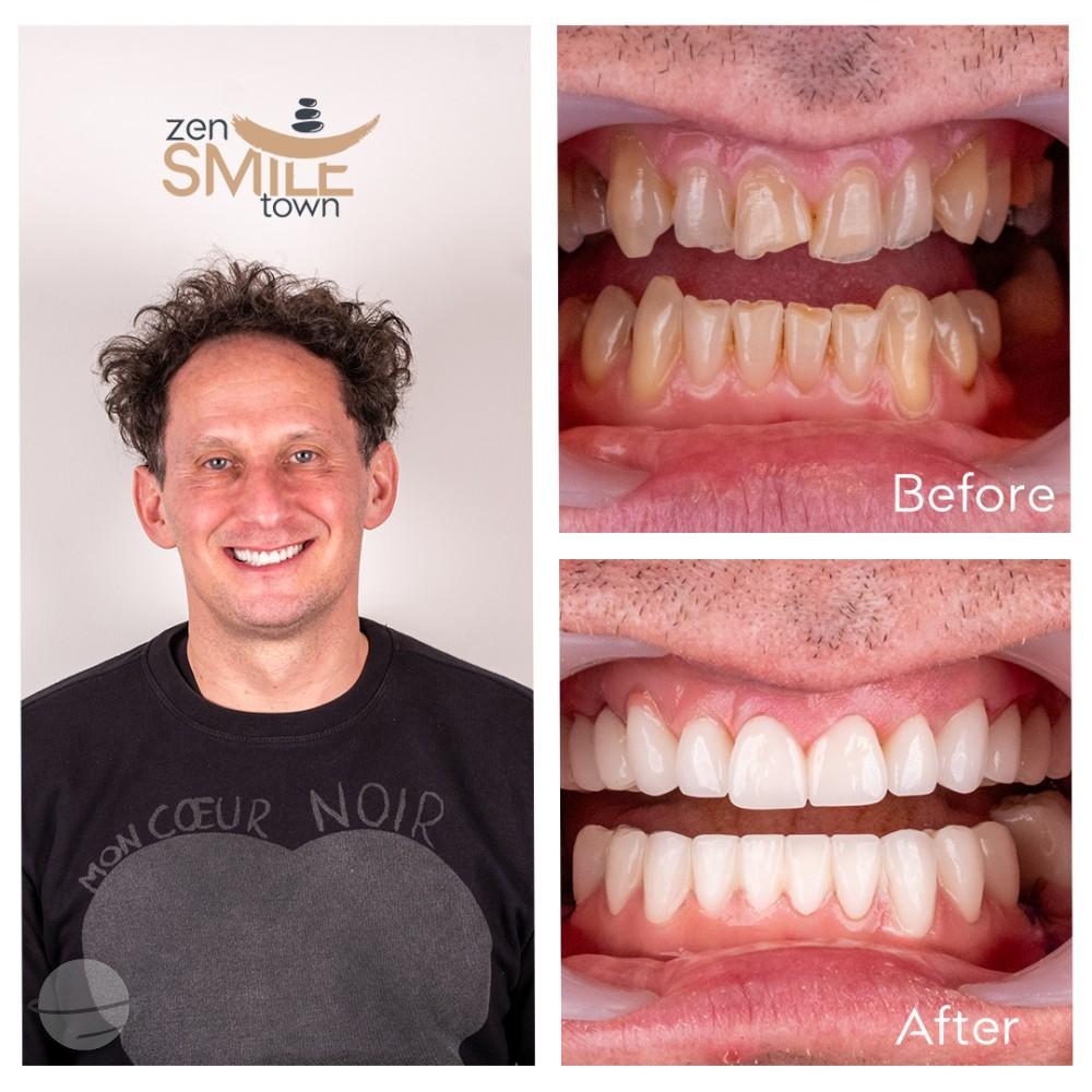 ZenSmileTown Dental Results27