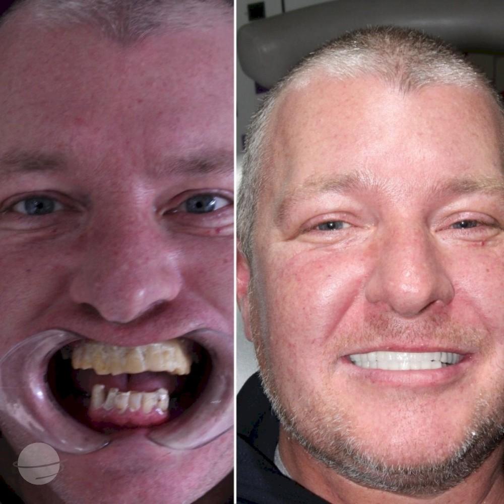 Ephesus dental results4