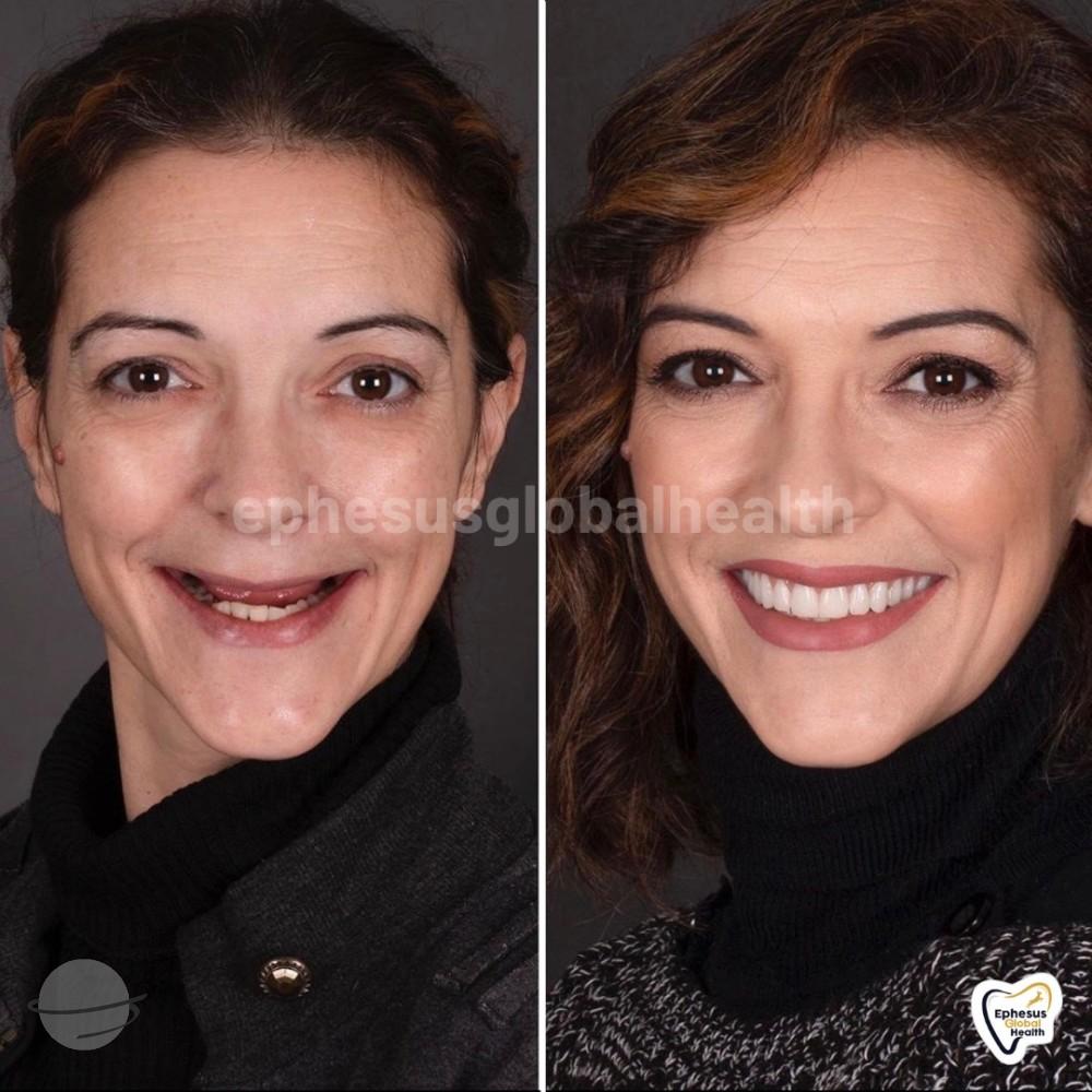 Ephesus dental results12