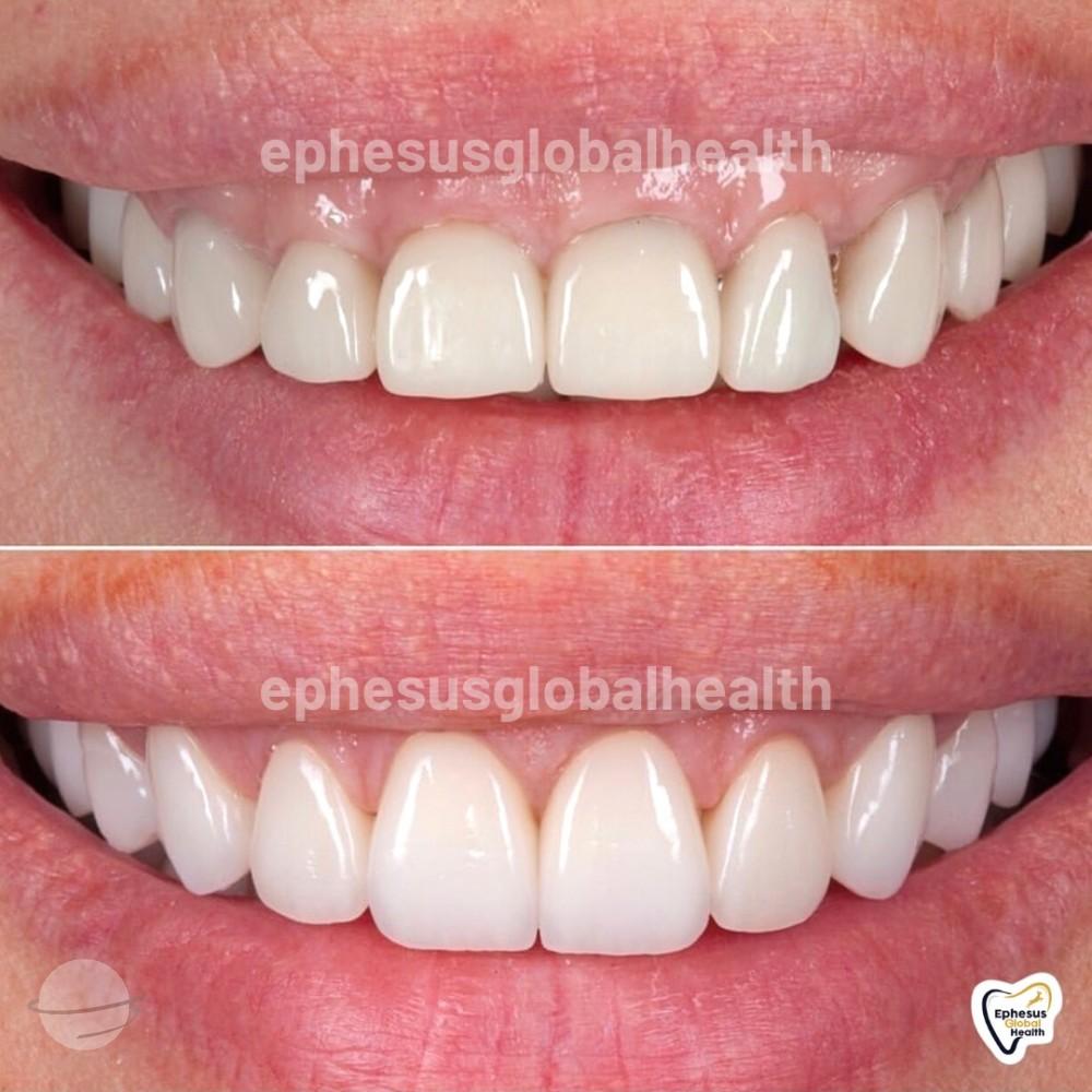 Ephesus dental results36
