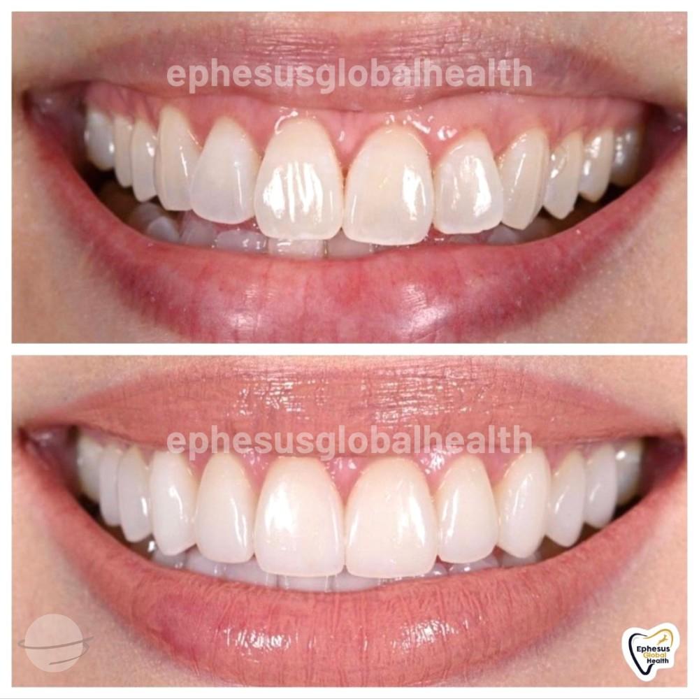Ephesus dental results34