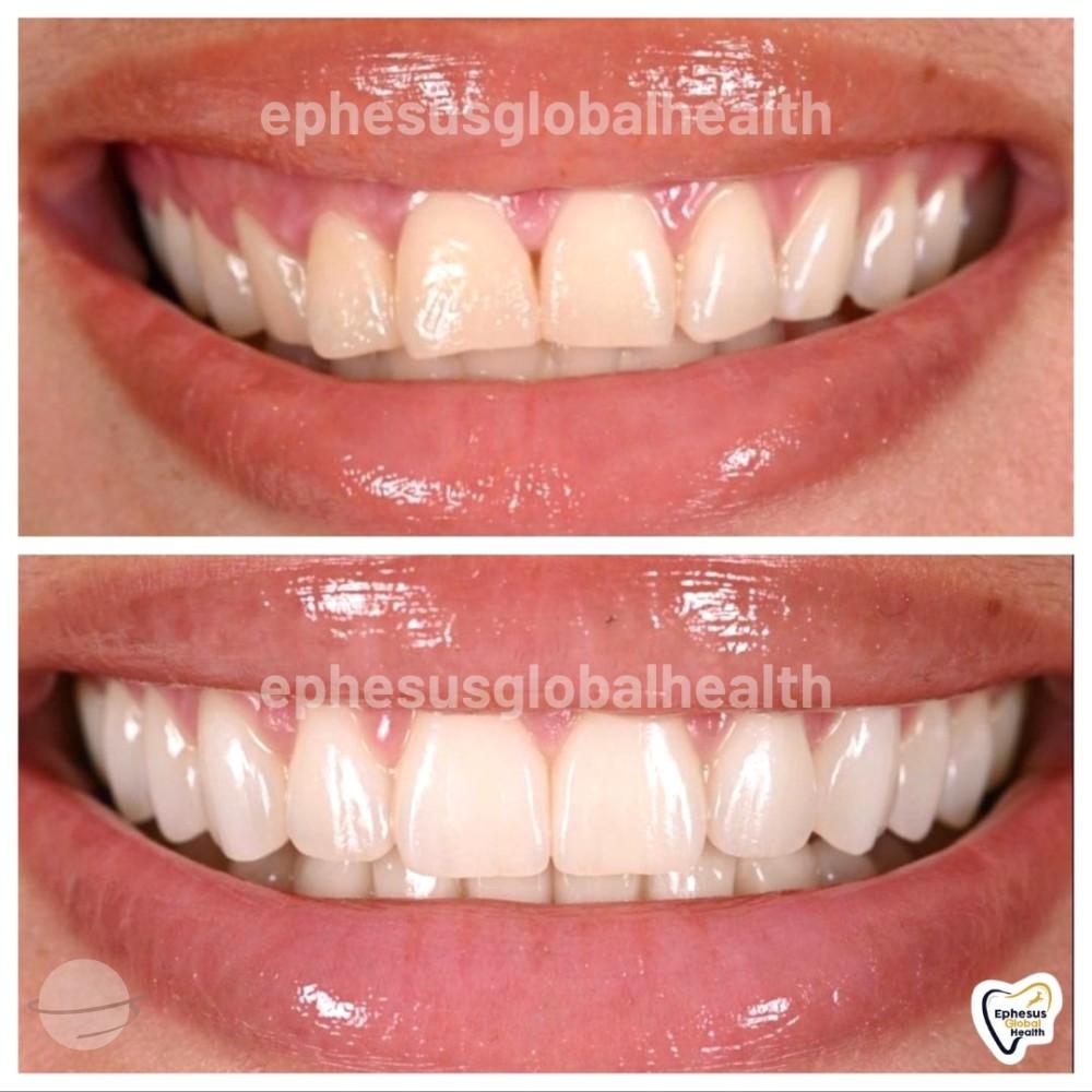 Ephesus dental results33