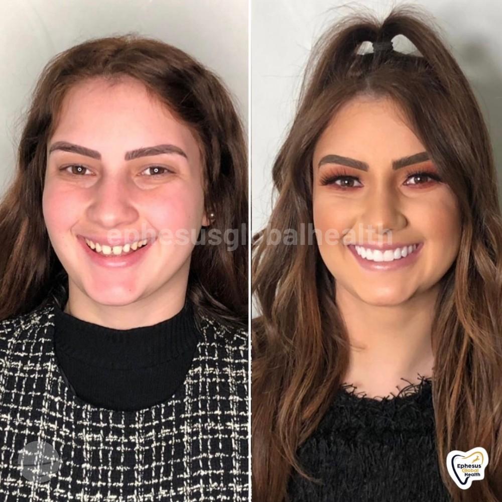 Ephesus dental results32