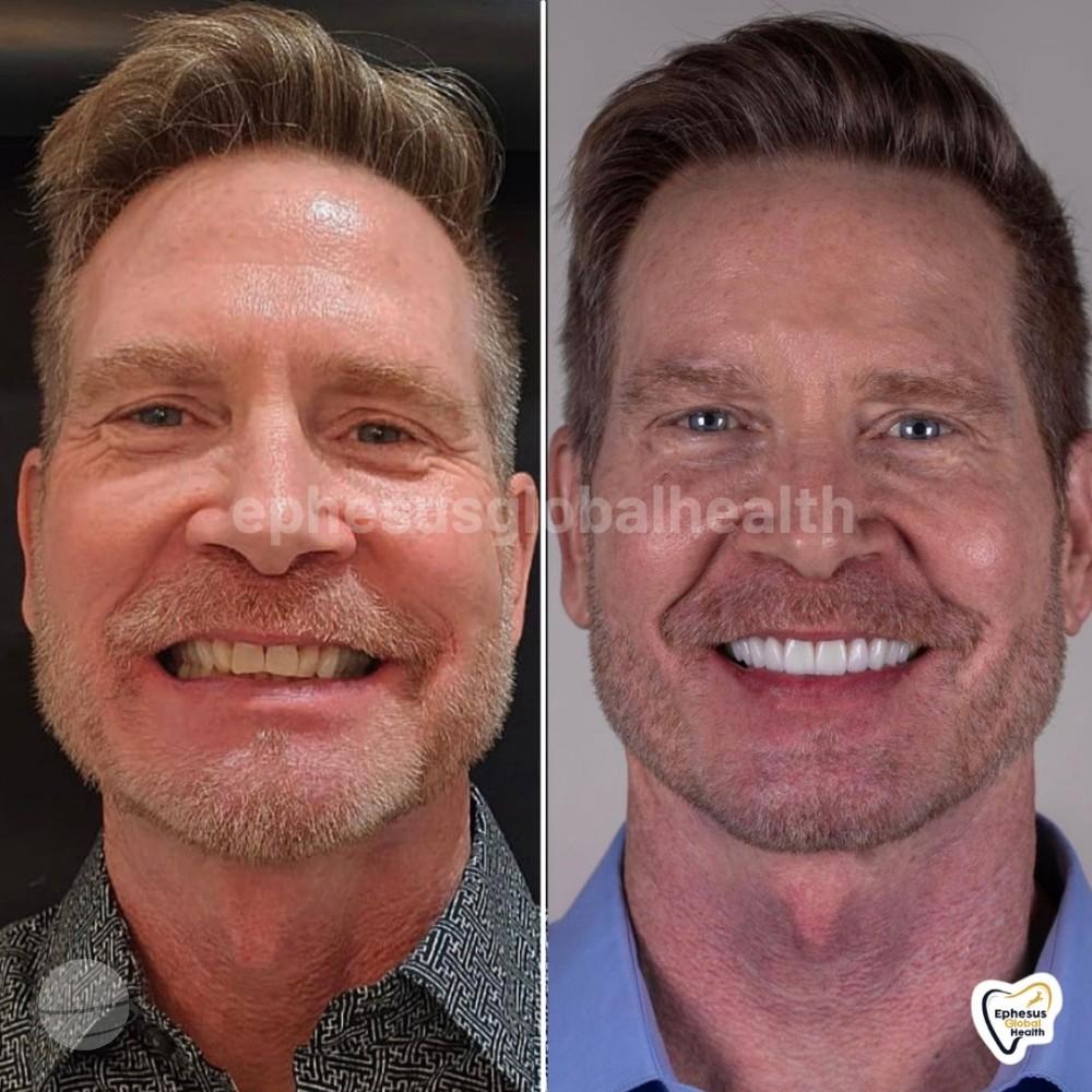 Ephesus dental results31