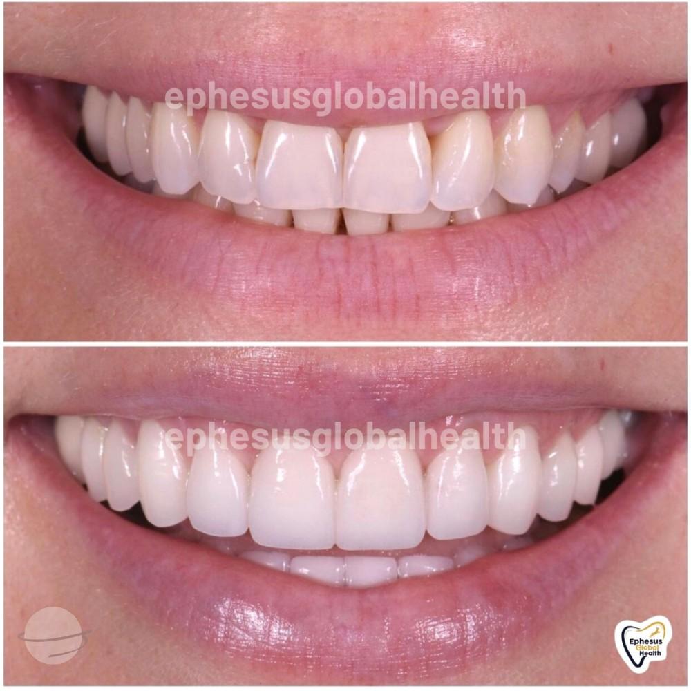 Ephesus dental results29