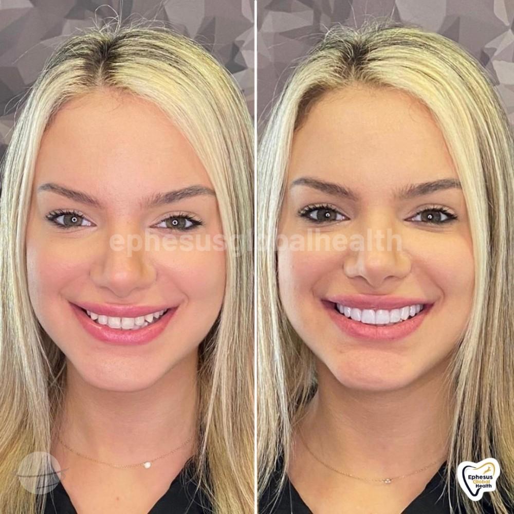 Ephesus dental results27