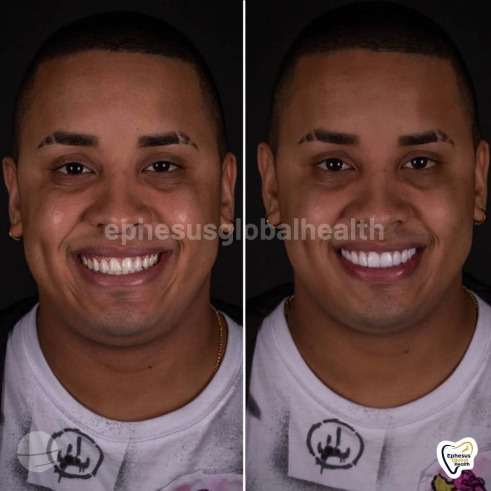 Ephesus dental results24