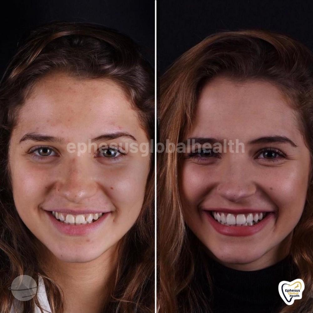 Ephesus dental results23