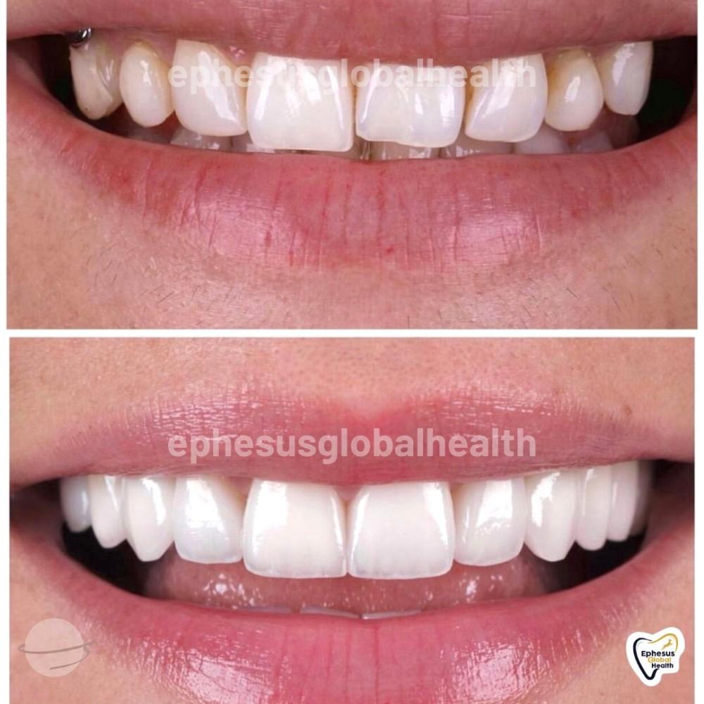 Ephesus dental results22
