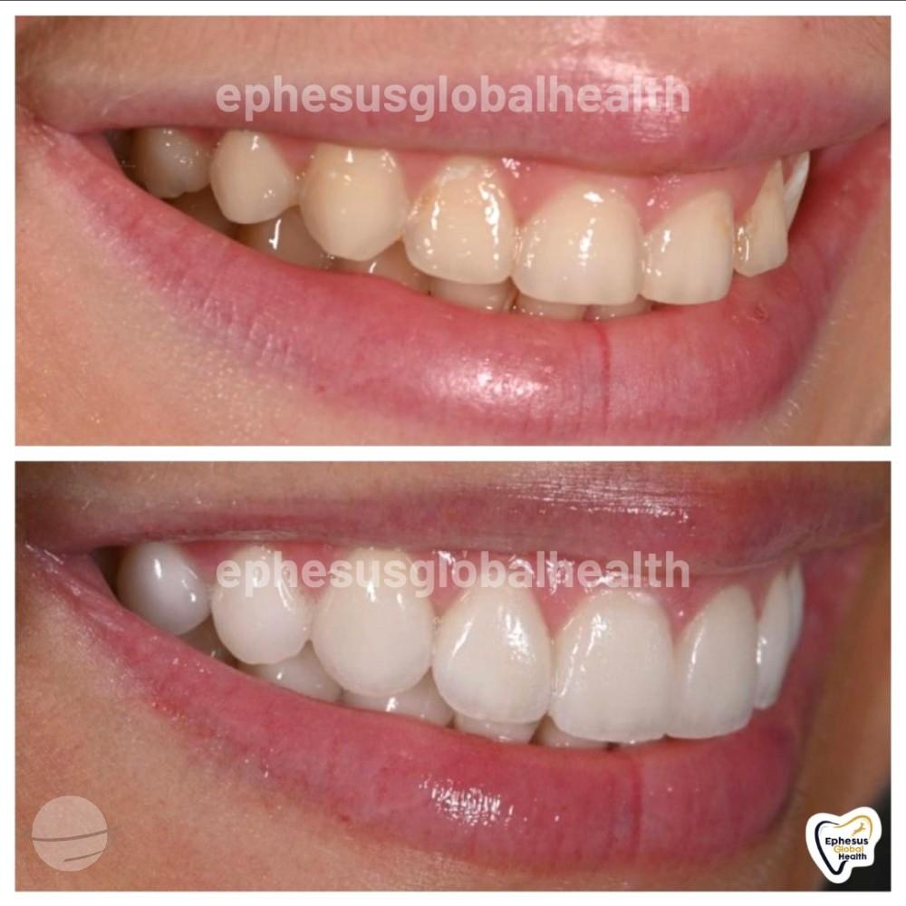 Ephesus dental results21