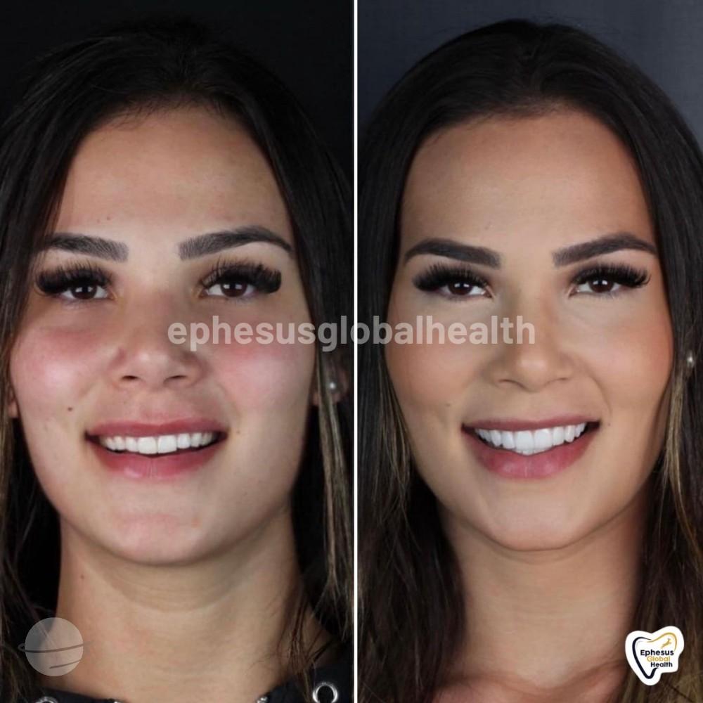 Ephesus dental results19