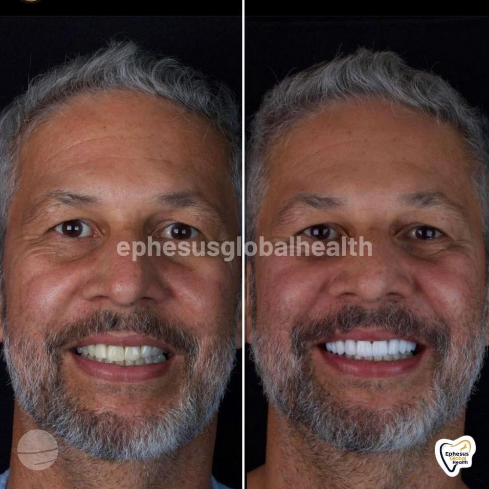 Ephesus dental results16