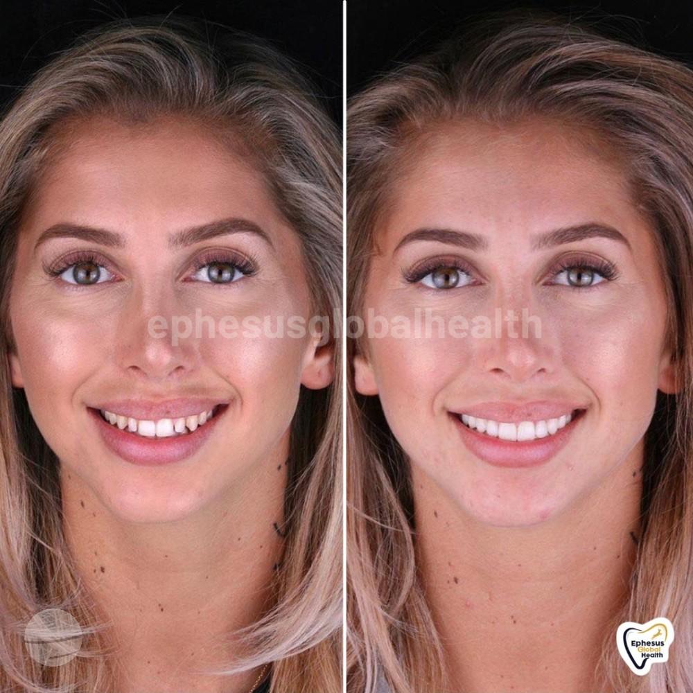 Ephesus dental results14