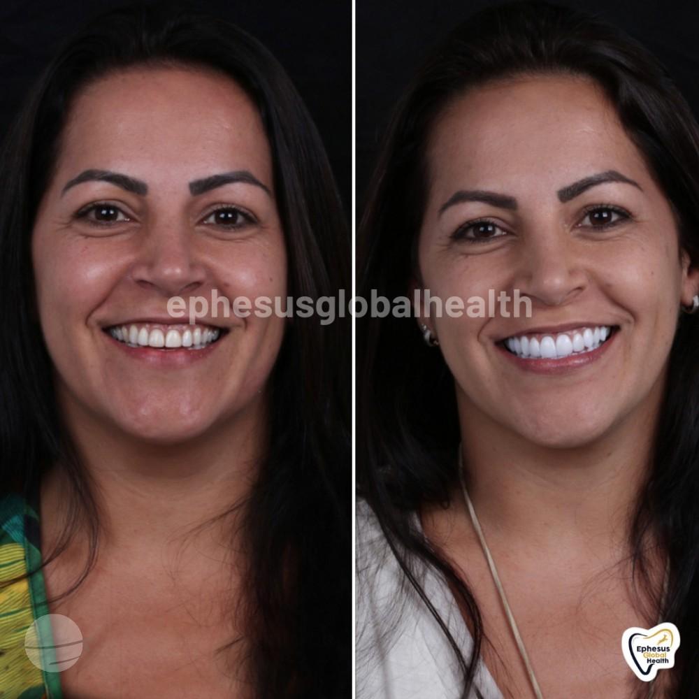 Ephesus dental results13