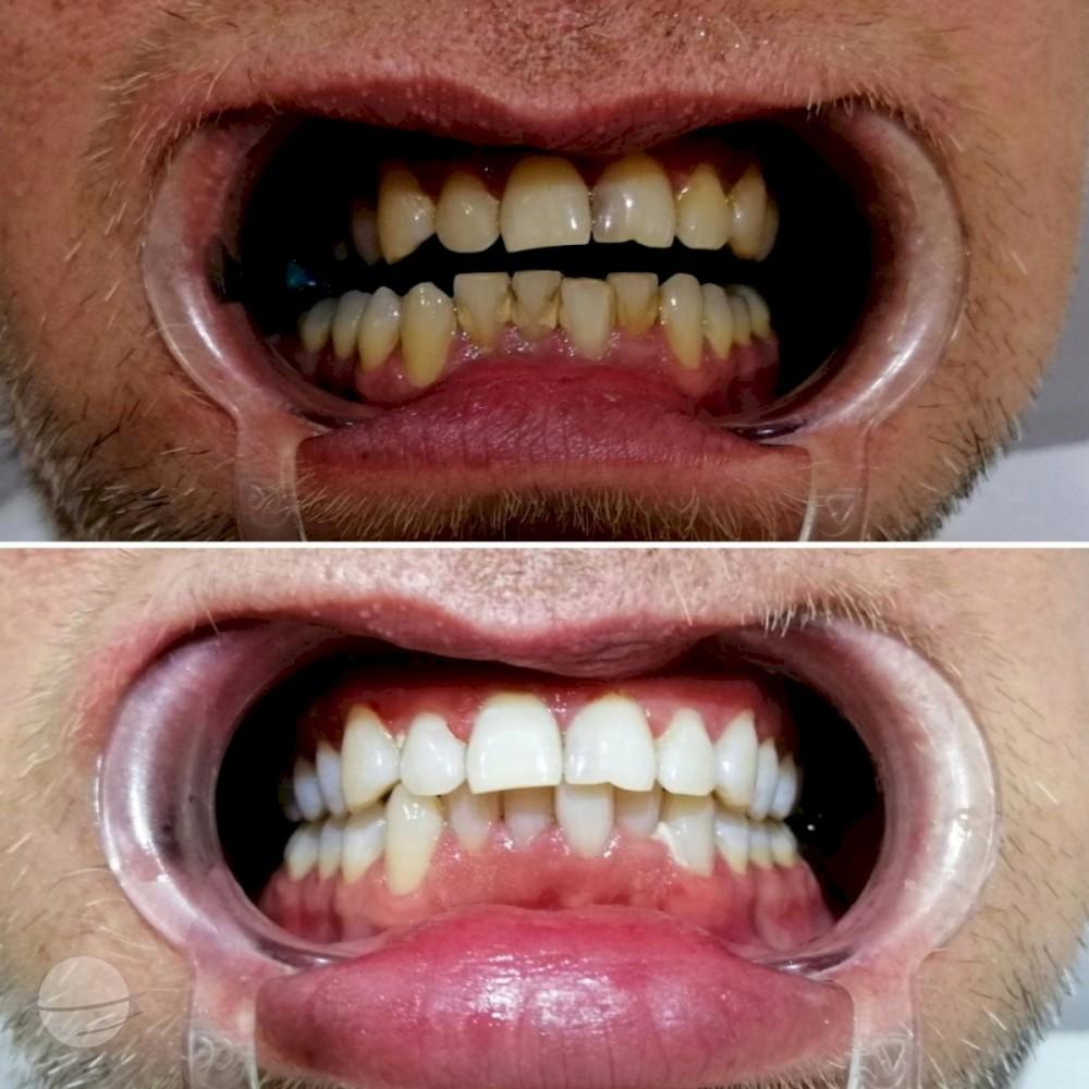 Ephesus dental results11