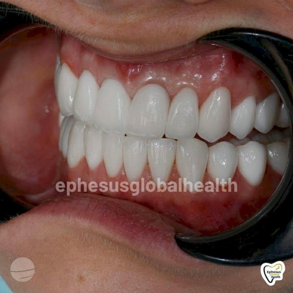 Ephesus dental results10