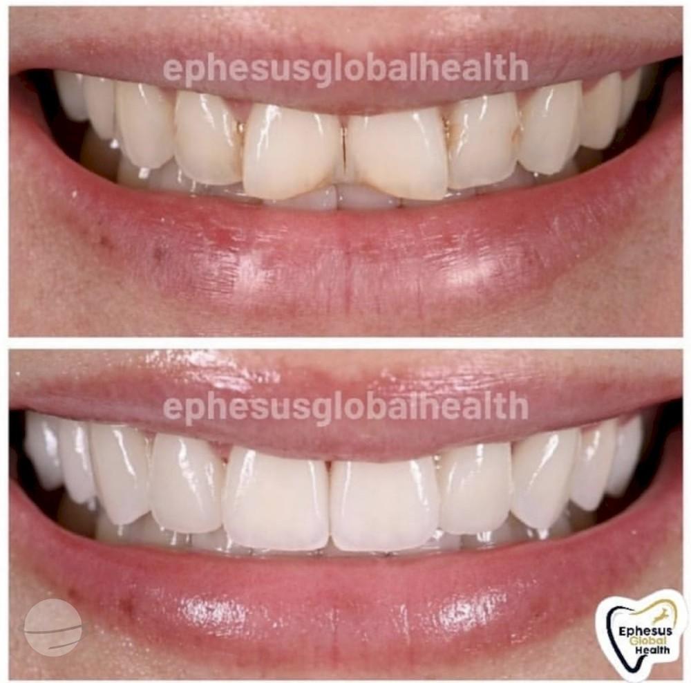 Ephesus dental results8