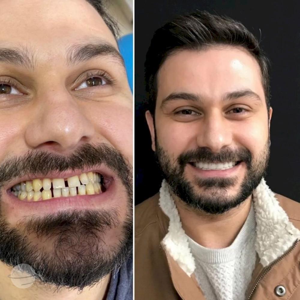 Ephesus dental results5