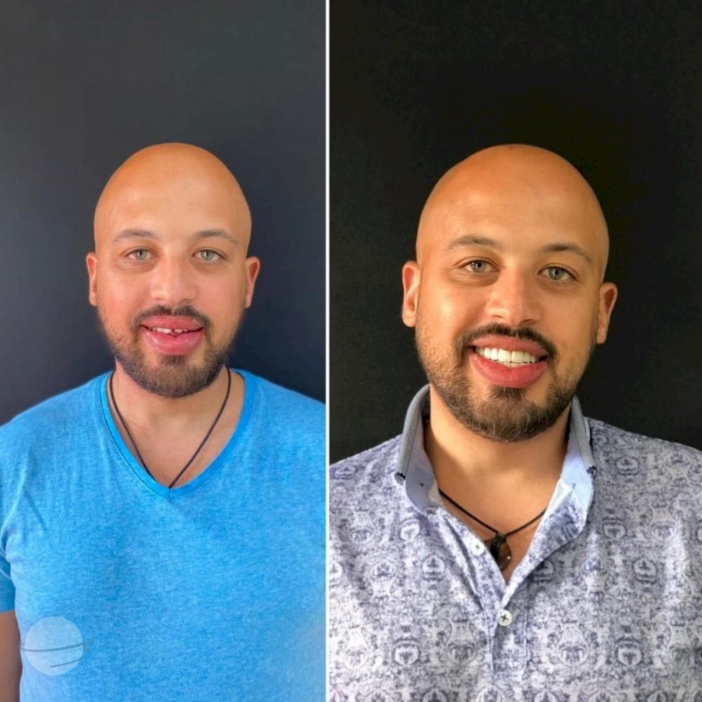 Ephesus dental results3