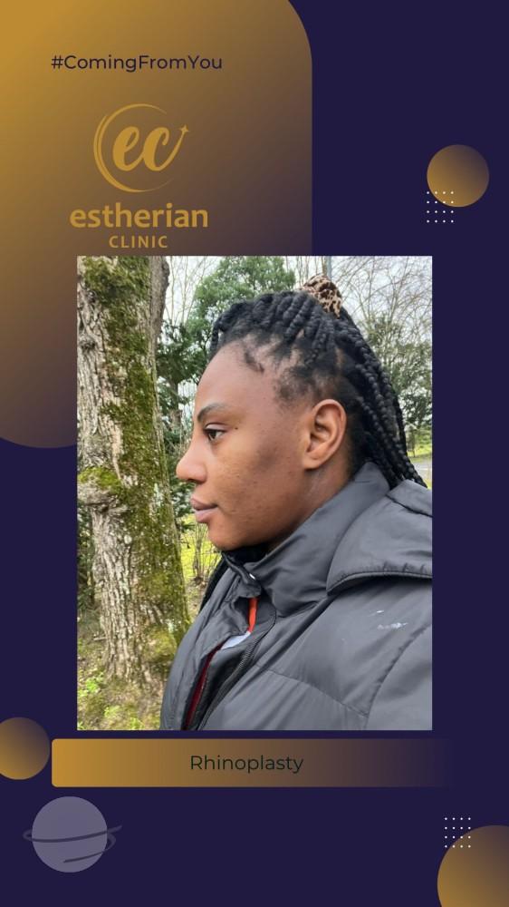 estherian Face Surgery 3
