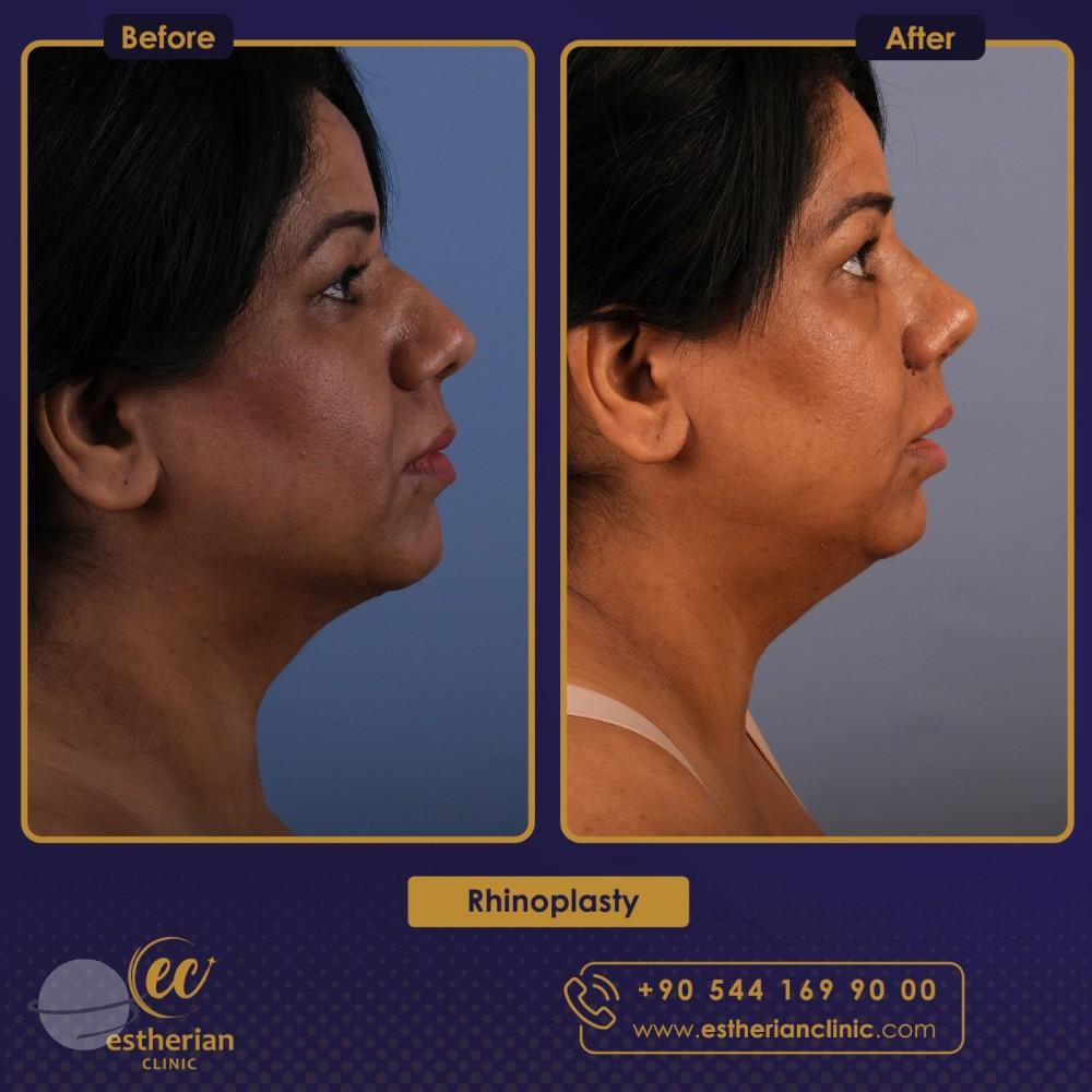 estherian Face Surgery 4