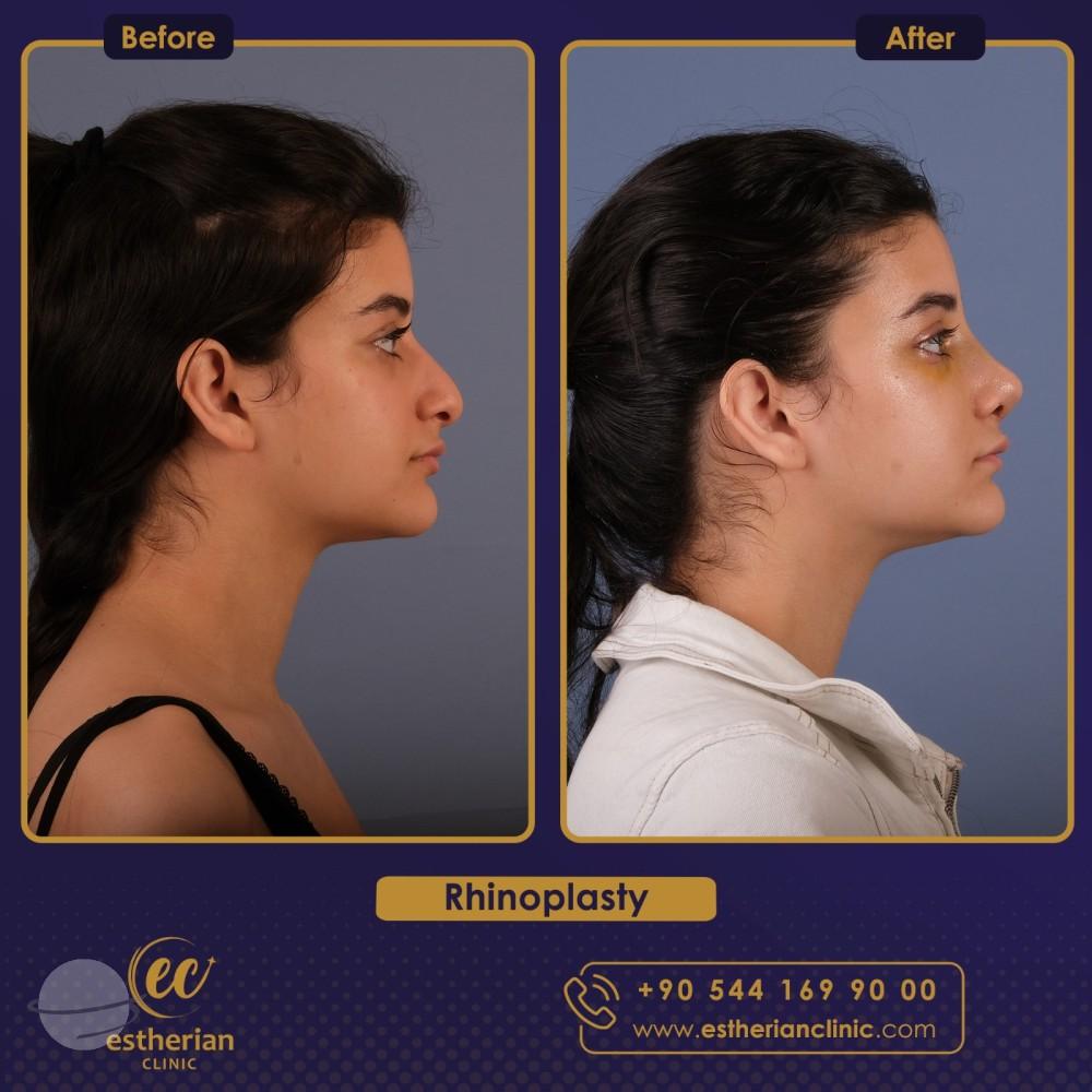 estherian Face Surgery 6