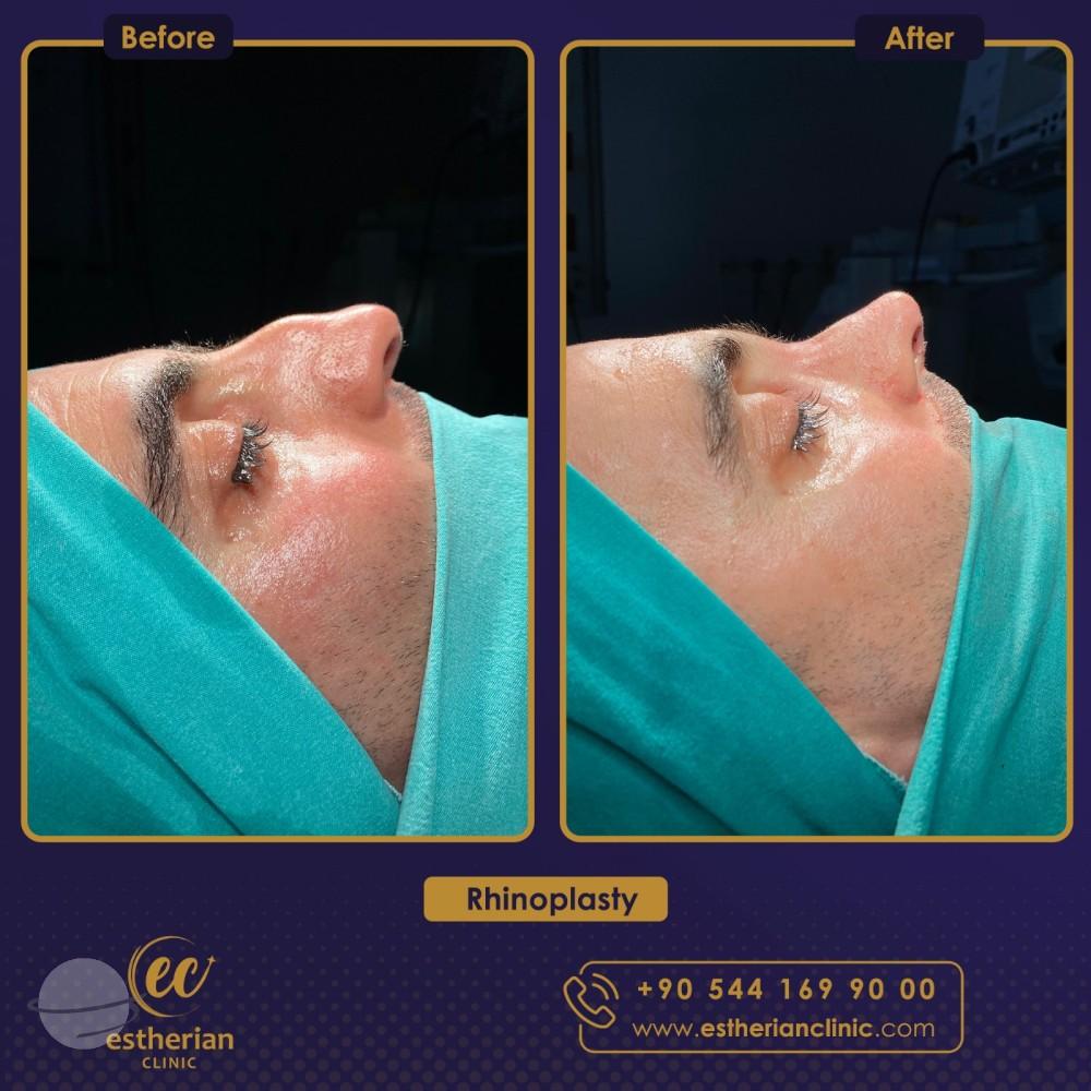 estherian Face Surgery 7