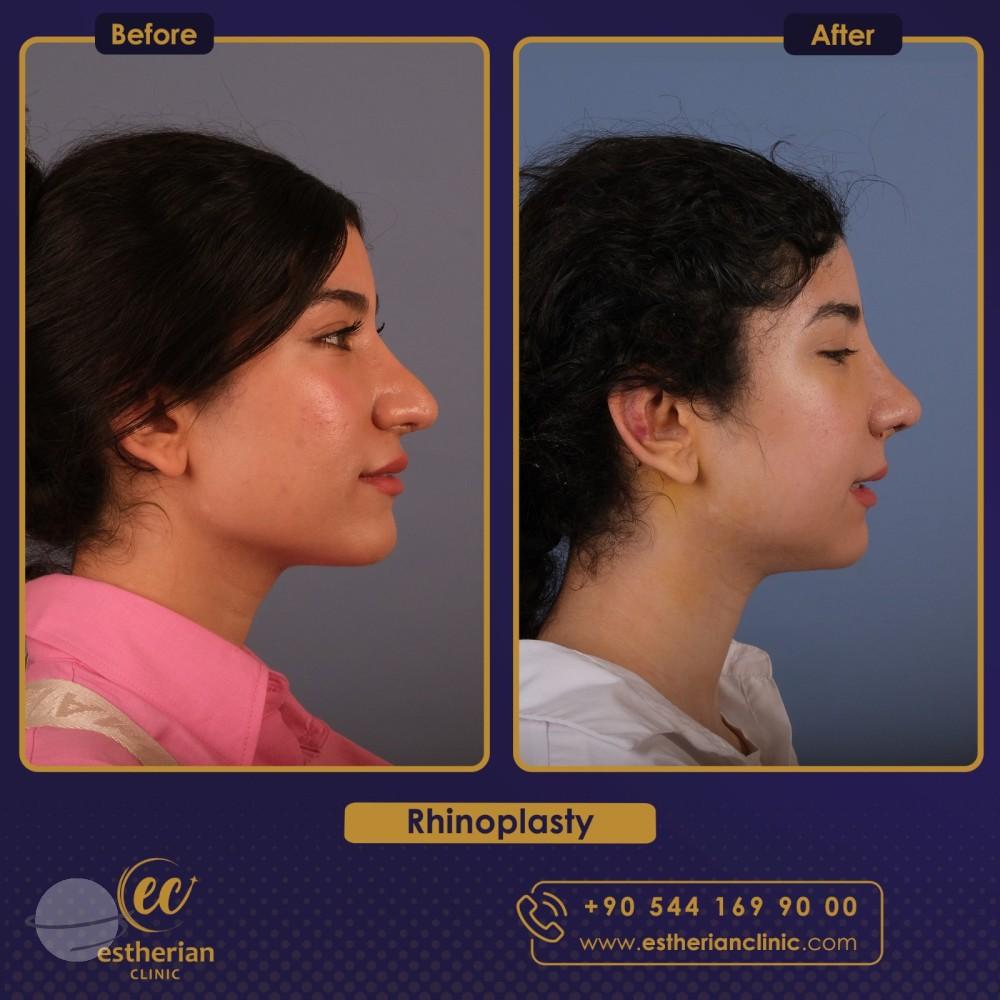 estherian Face Surgery 8