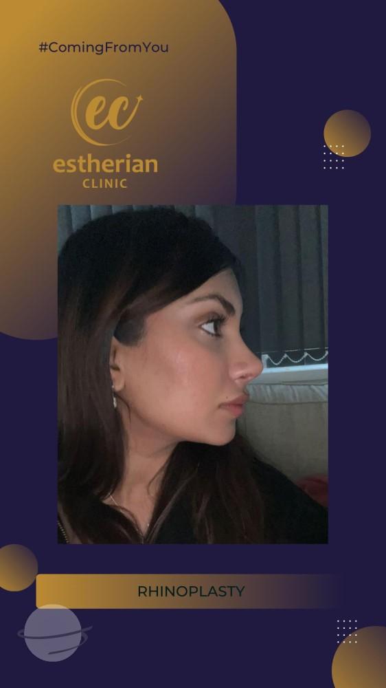estherian Face Surgery 10