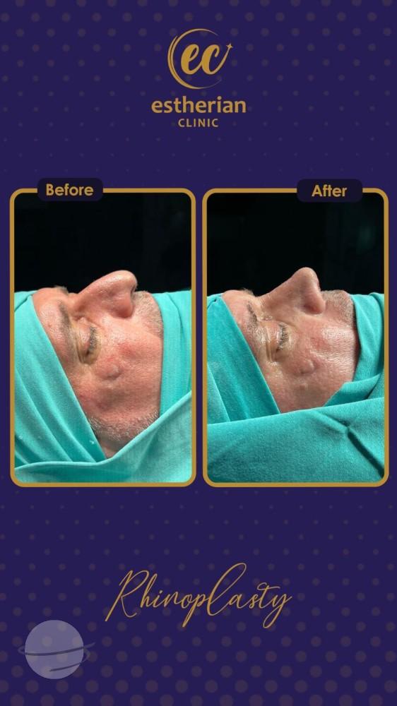 estherian Face Surgery 15-min