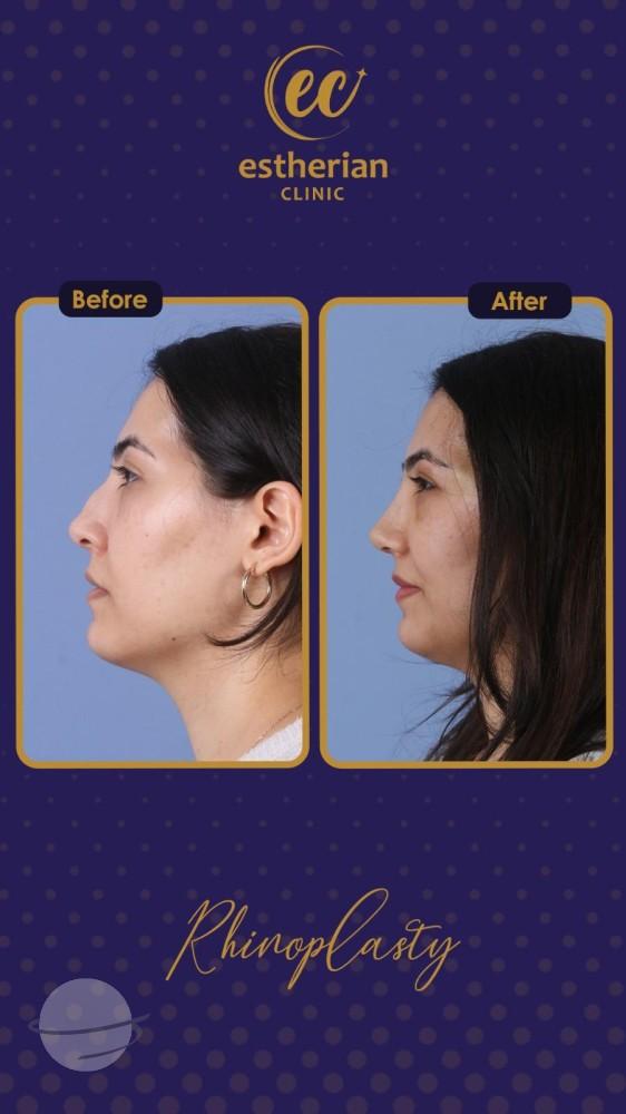 estherian Face Surgery 18-min