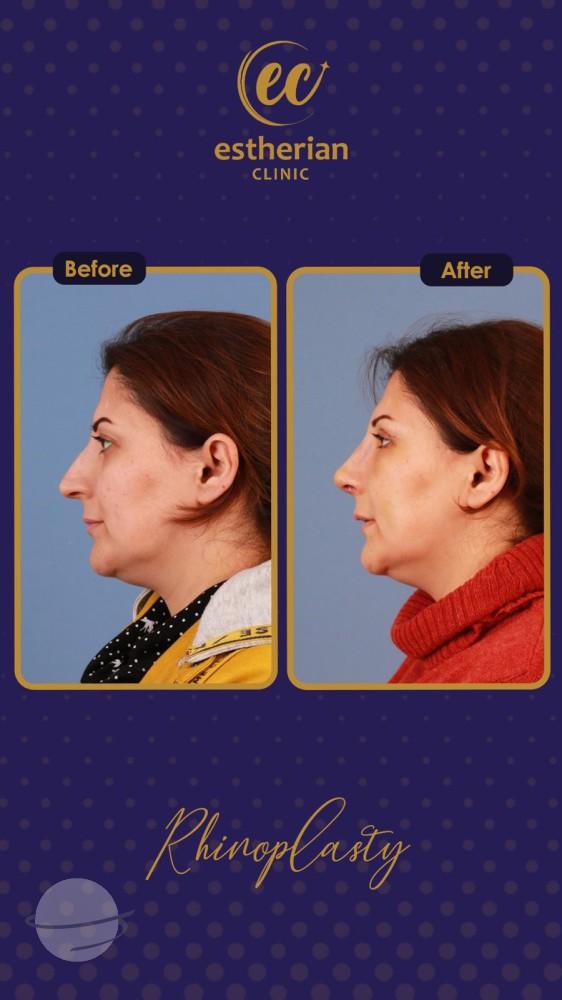 estherian Face Surgery 20-min