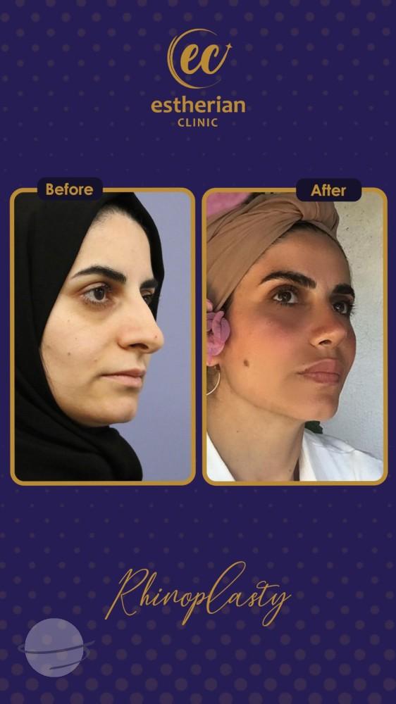 estherian Face Surgery 24-min