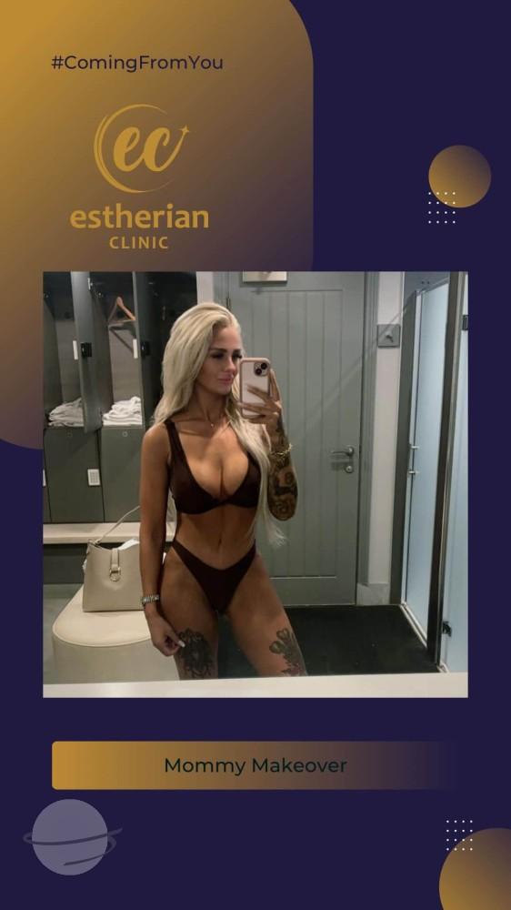 estherian BODY Surgery 2-min