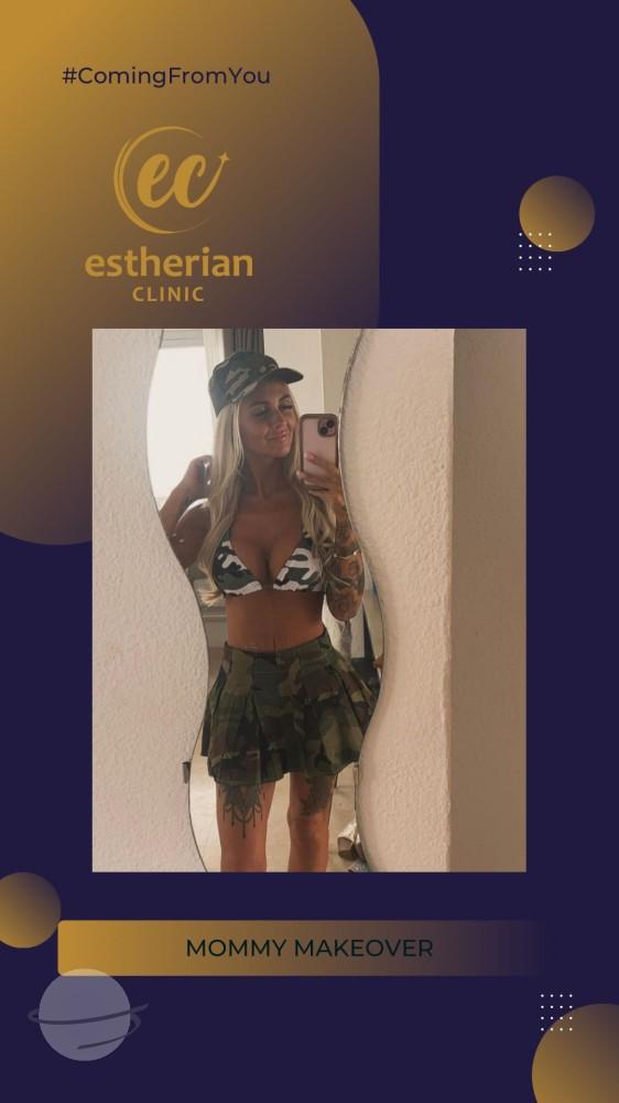 estherian BODY Surgery 19-min