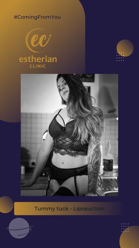 estherian BODY Surgery 9-min
