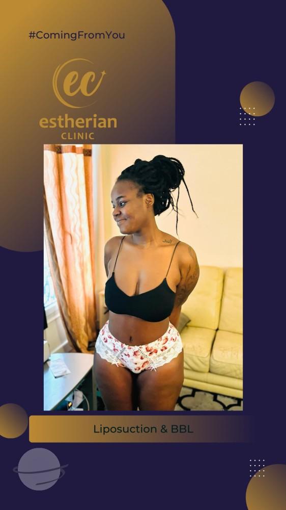 estherian BODY Surgery 6-min