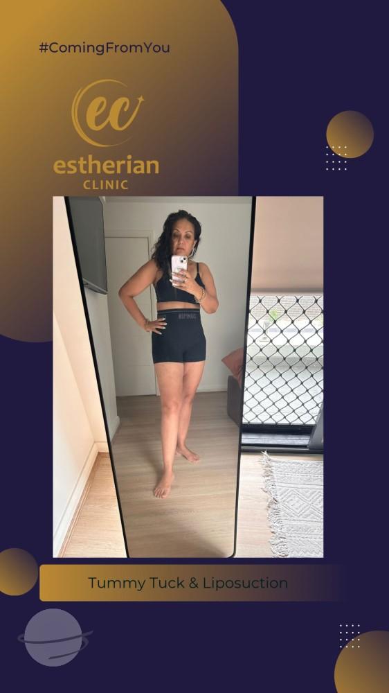 estherian BODY Surgery 7-min-1