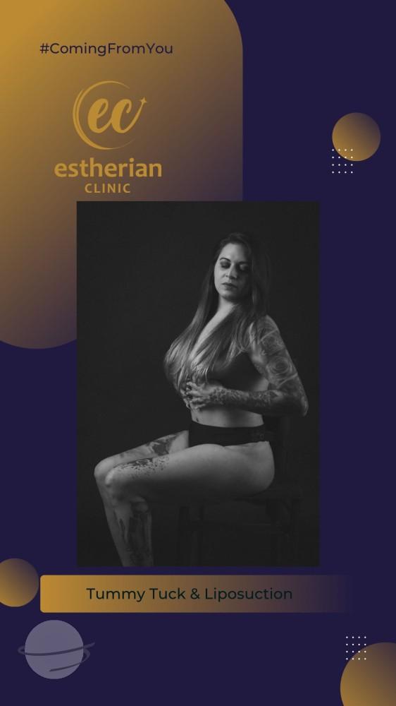 estherian BODY Surgery 8-min