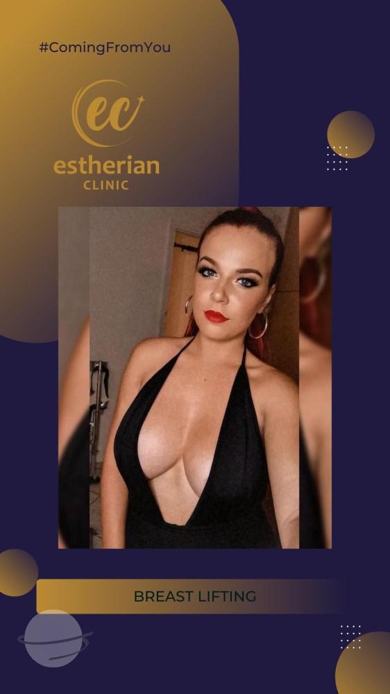 estherian Breast Surgery 10