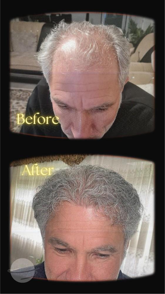 estherian Hair Surgery 4
