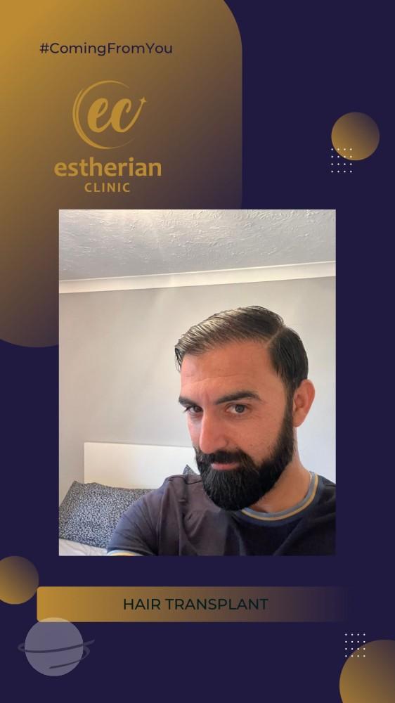 estherian Hair Surgery 6