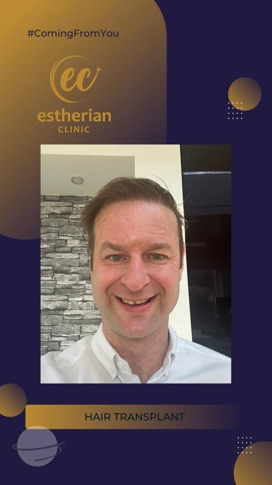estherian Hair Surgery 7