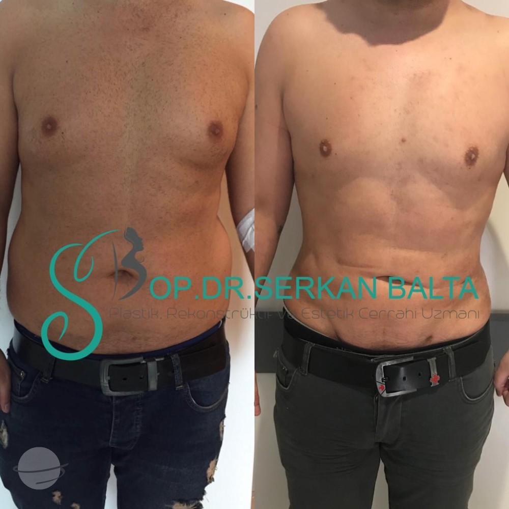 ELIT CLINIC COSMETIC SURGERY RESULTS 5