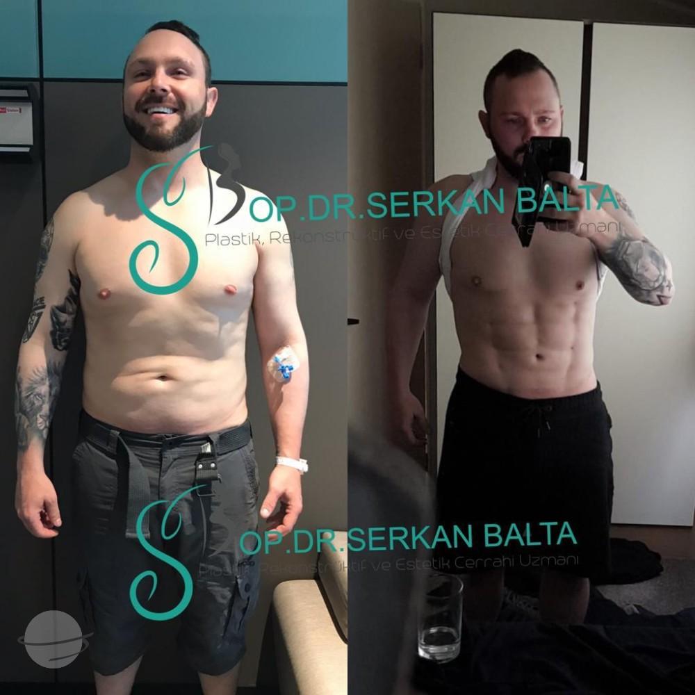 ELIT CLINIC COSMETIC SURGERY RESULTS 3