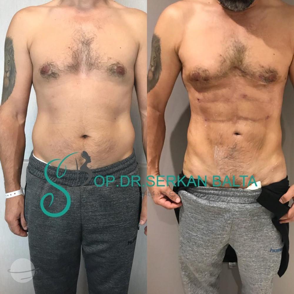 ELIT CLINIC COSMETIC SURGERY RESULTS 6